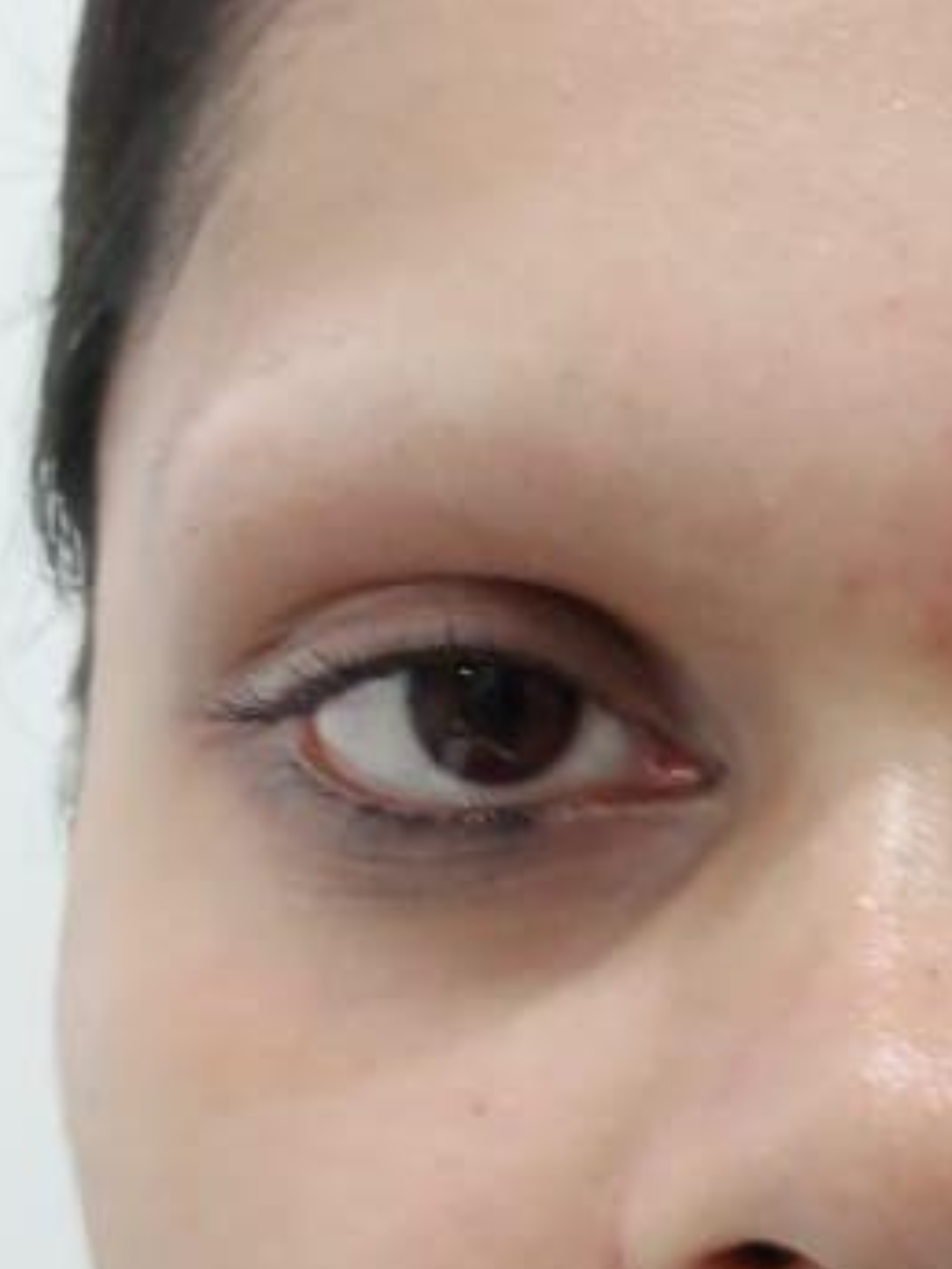 before-img