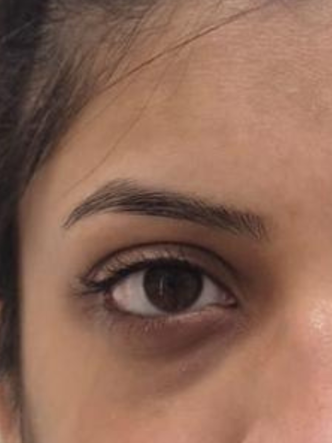 before-img