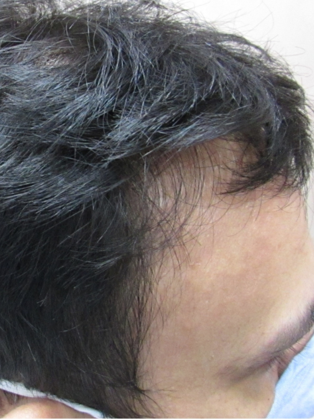 before-img