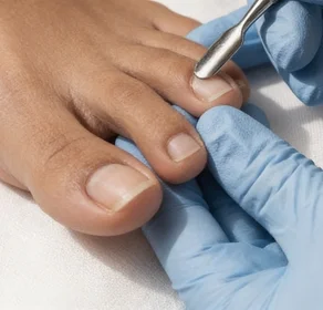 Foot Concerns