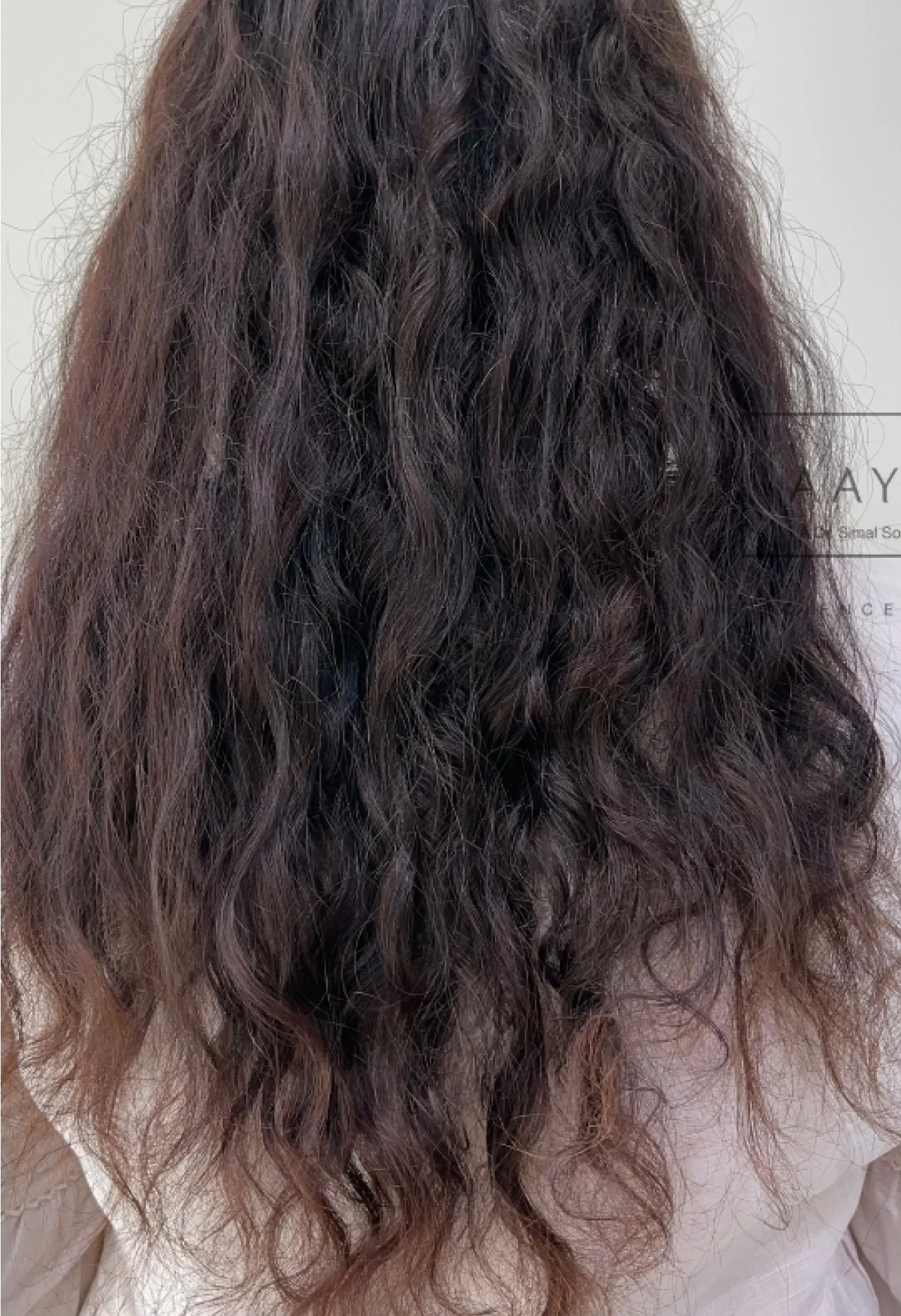 before-img