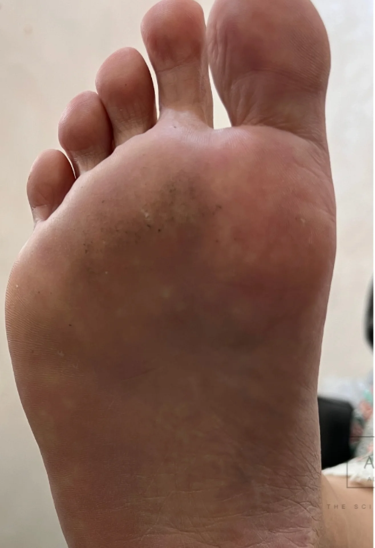 before-img