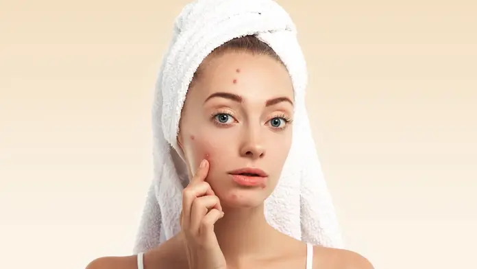 10 Summer skin problems and Solutions