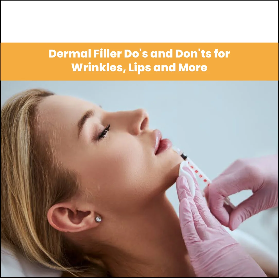 Dermal Filler Do’s and Don’ts for Wrinkles, Lips and More