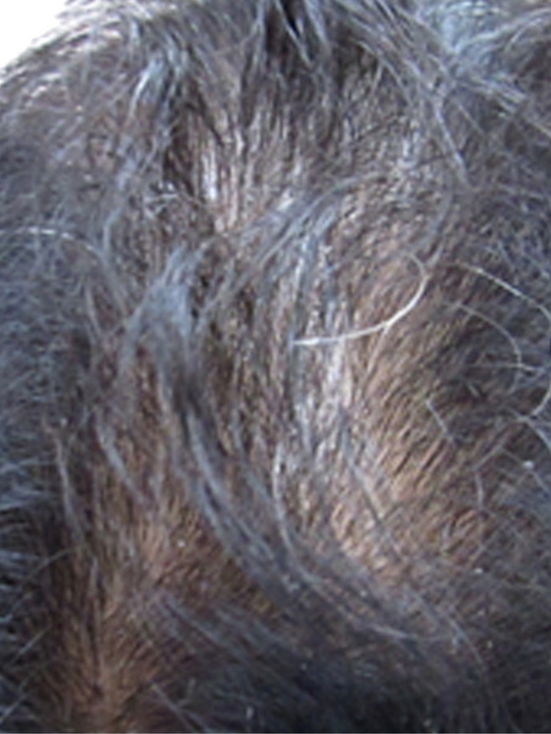 before-img
