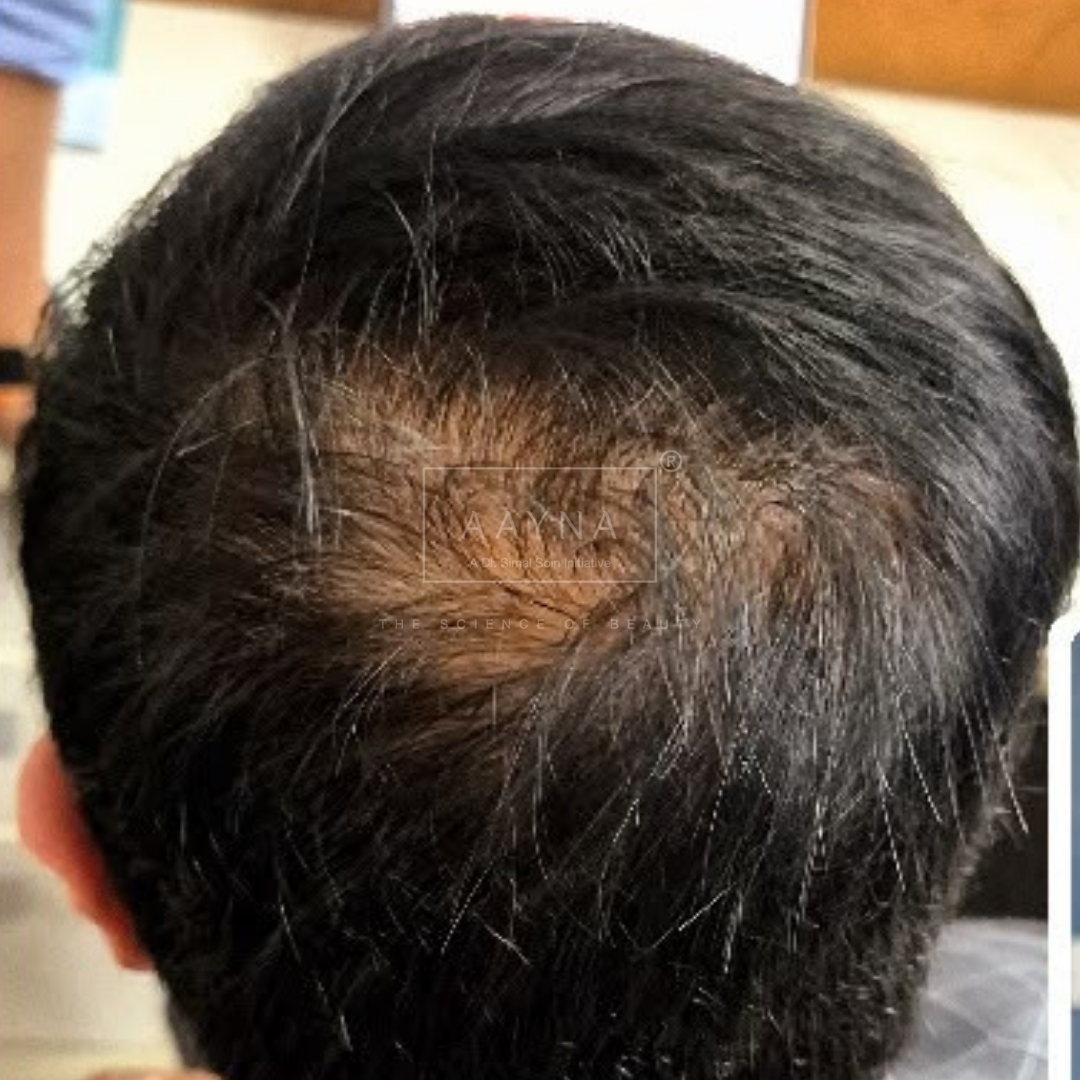 before-img