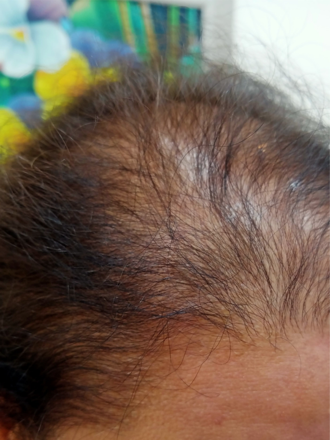 before-img