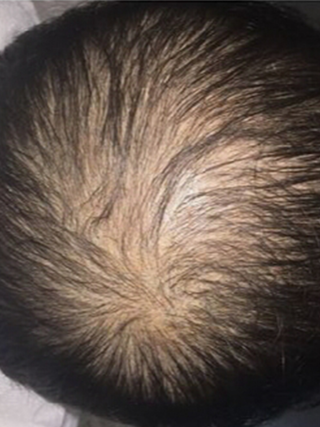 before-img