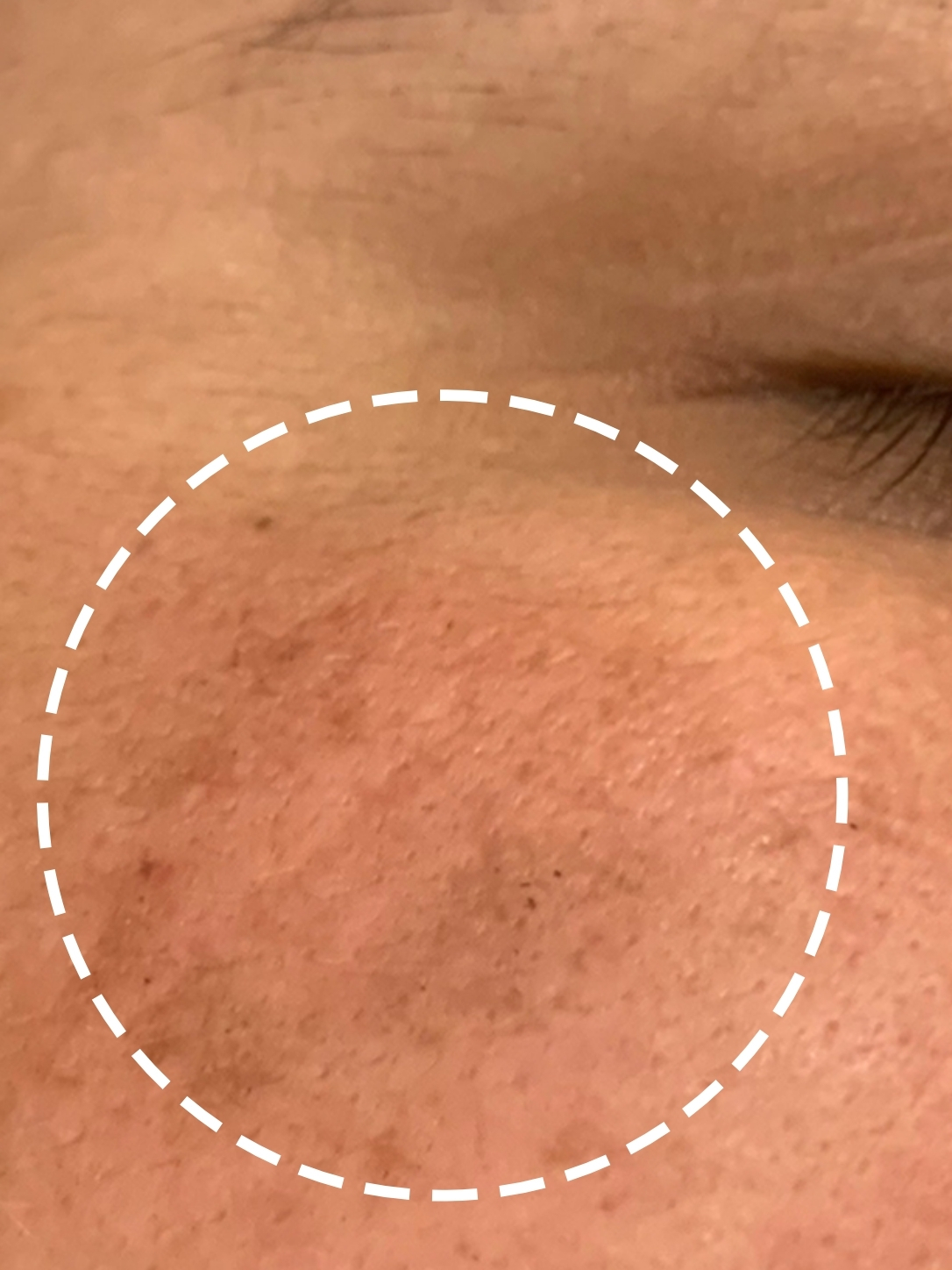 before-img