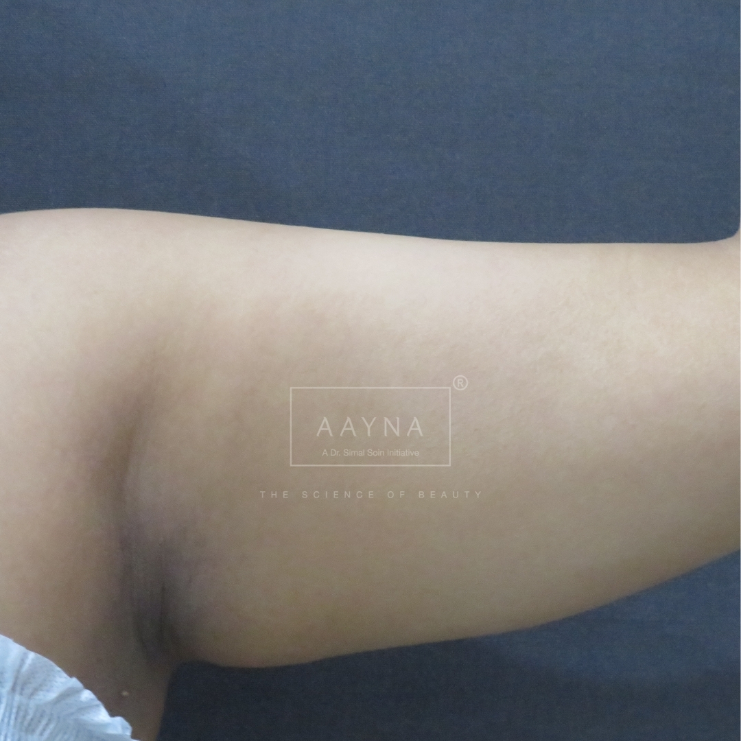 before-img