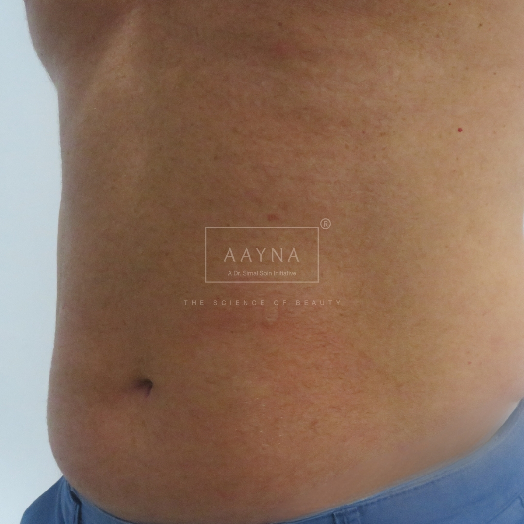 before-img