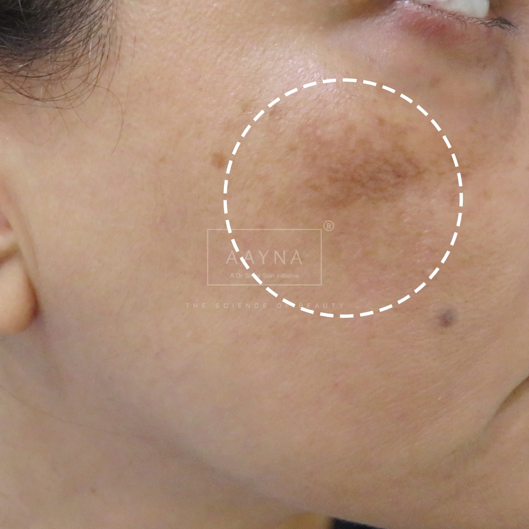 before-img