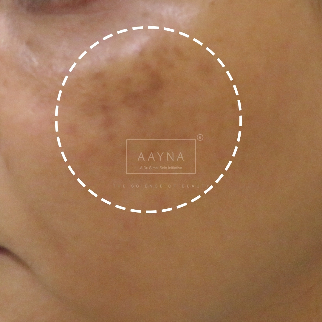 before-img