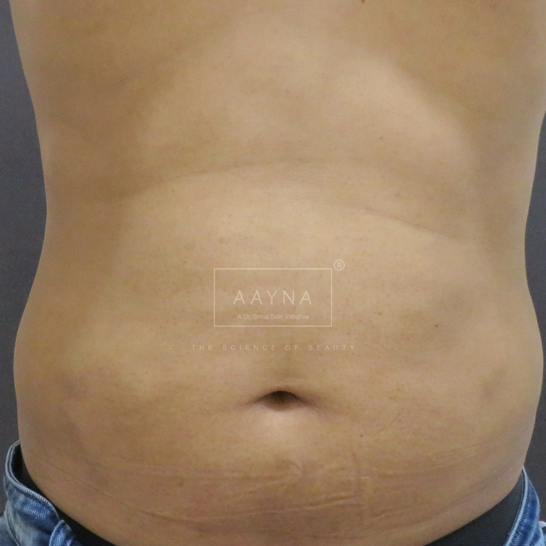 before-img