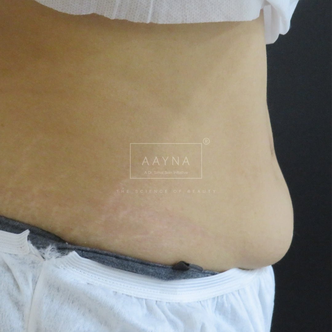 before-img