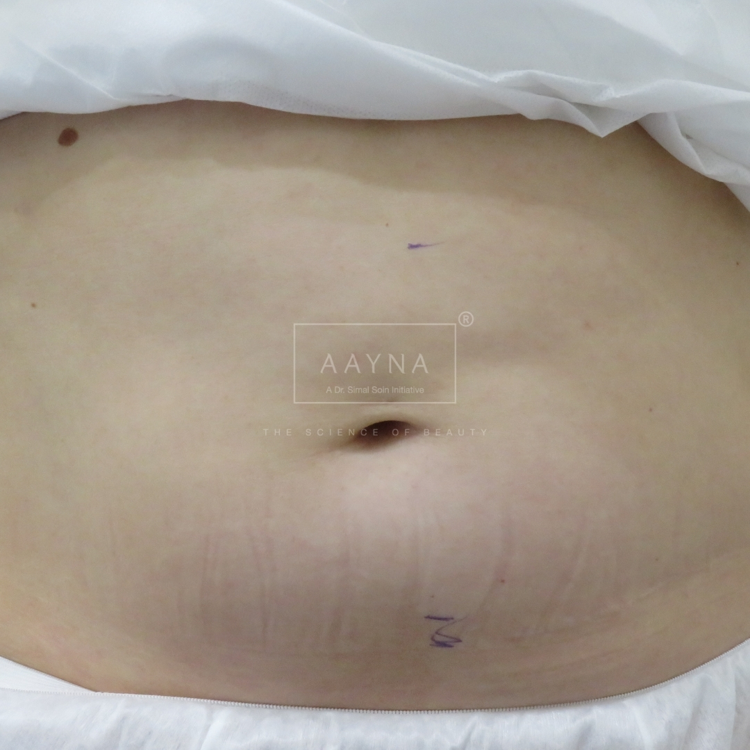 before-img