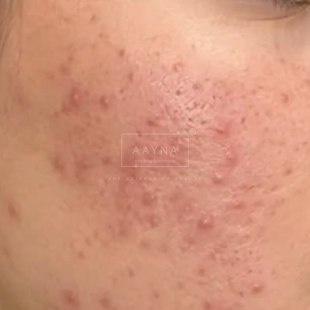 before-img