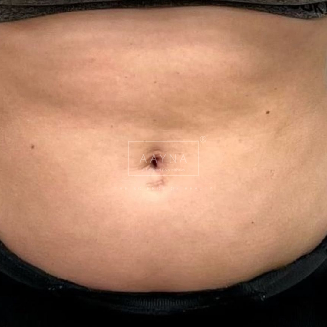 before-img