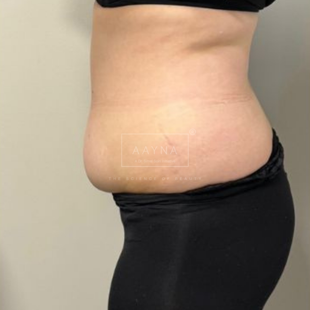 before-img