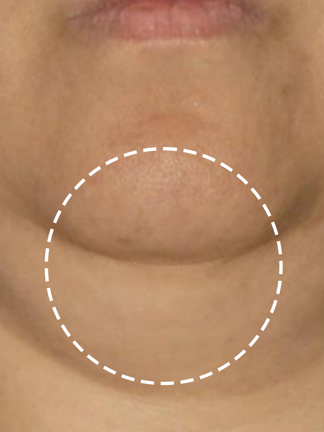 before-img