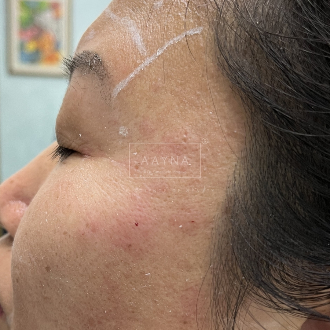 before-img