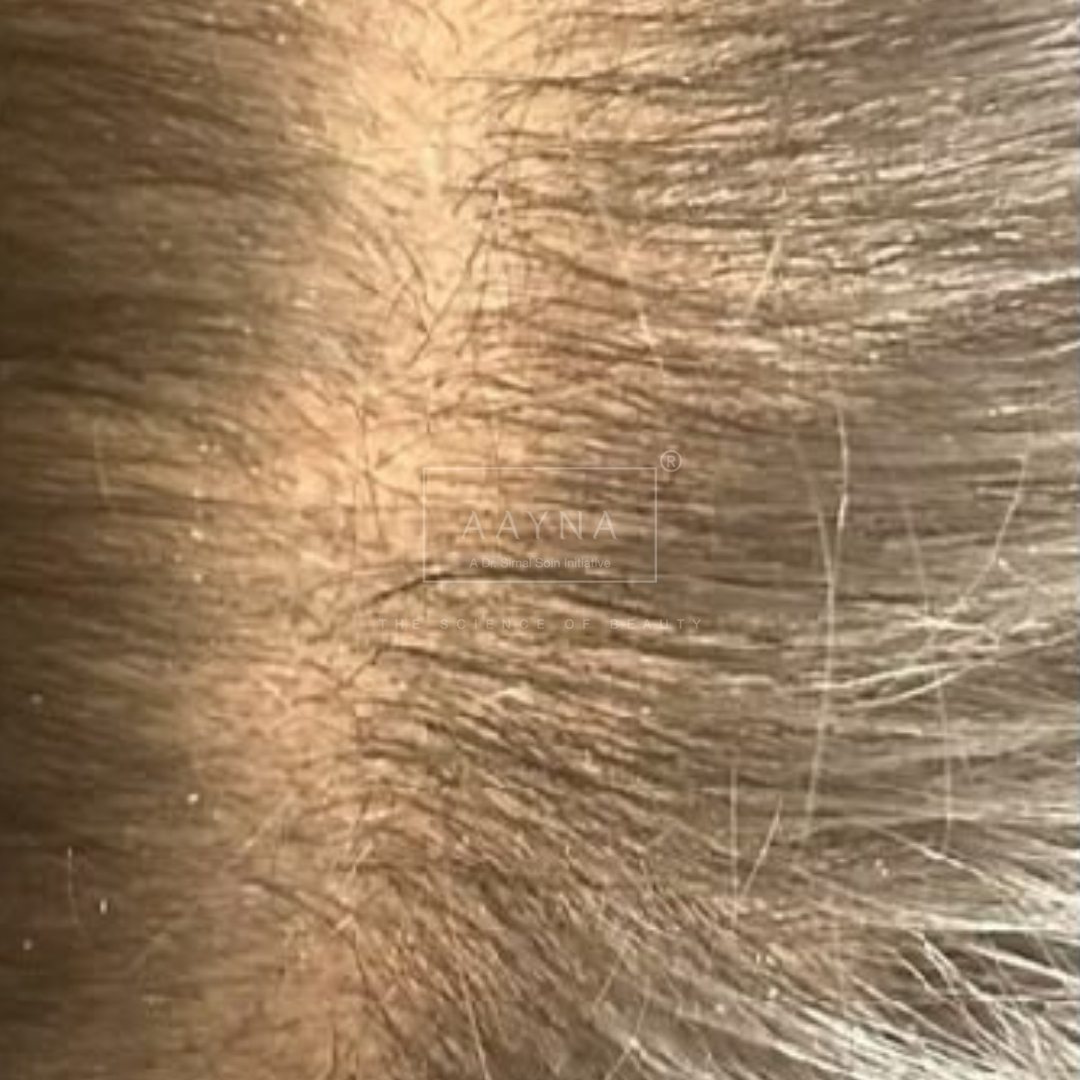 before-img