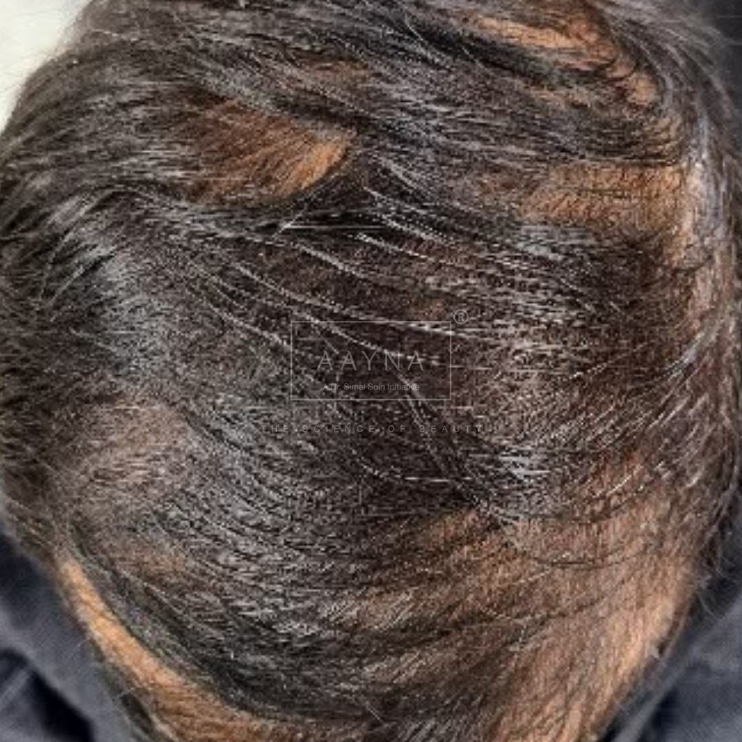 before-img