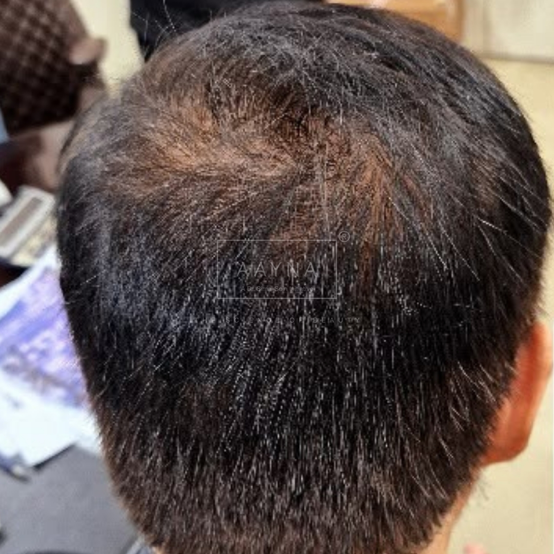 before-img