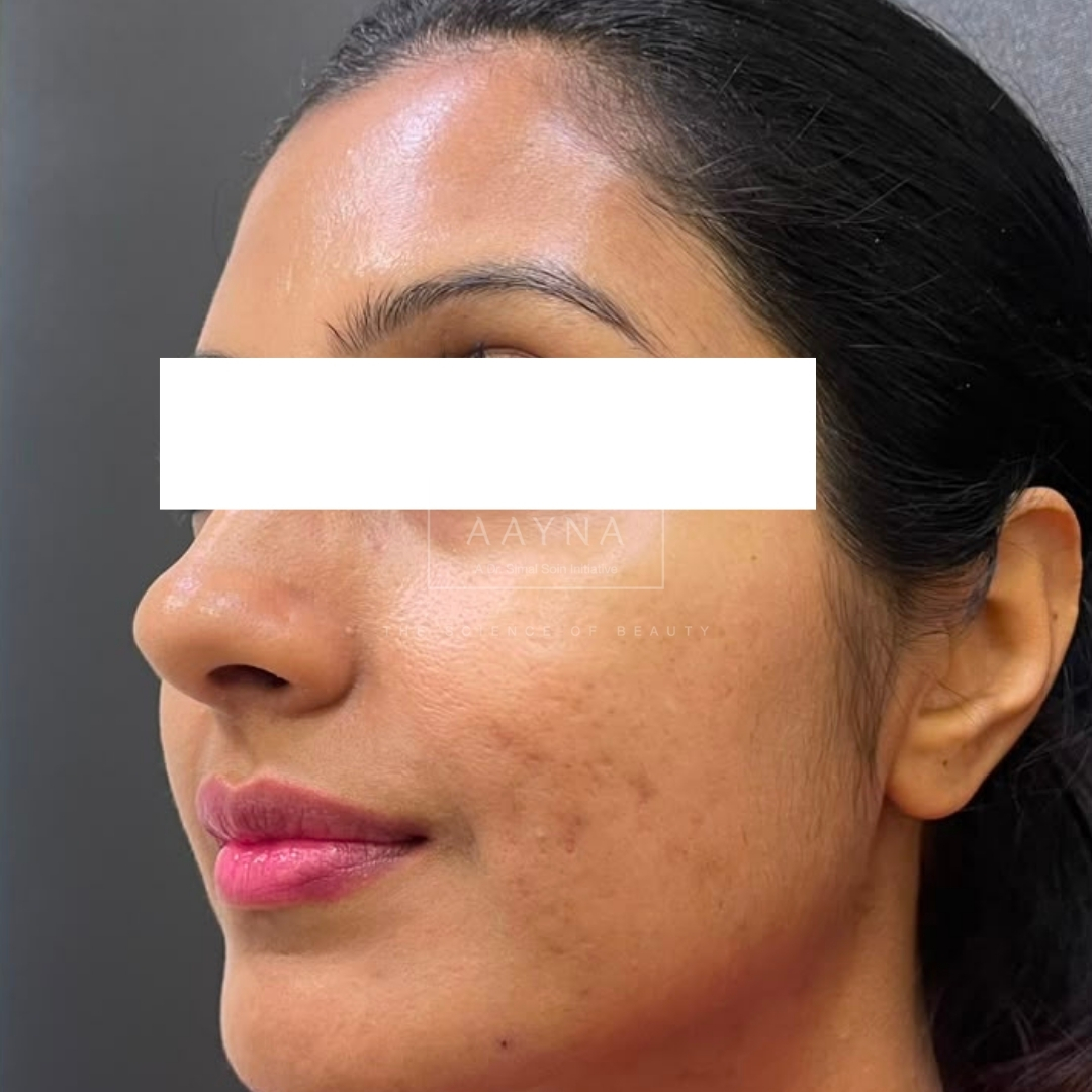 before-img
