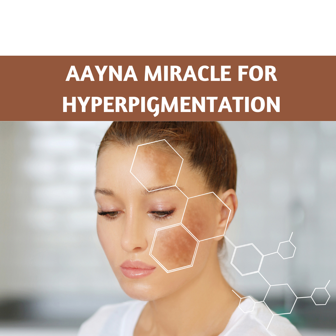Removing Hyperpigmentation with AAYNA Miracle