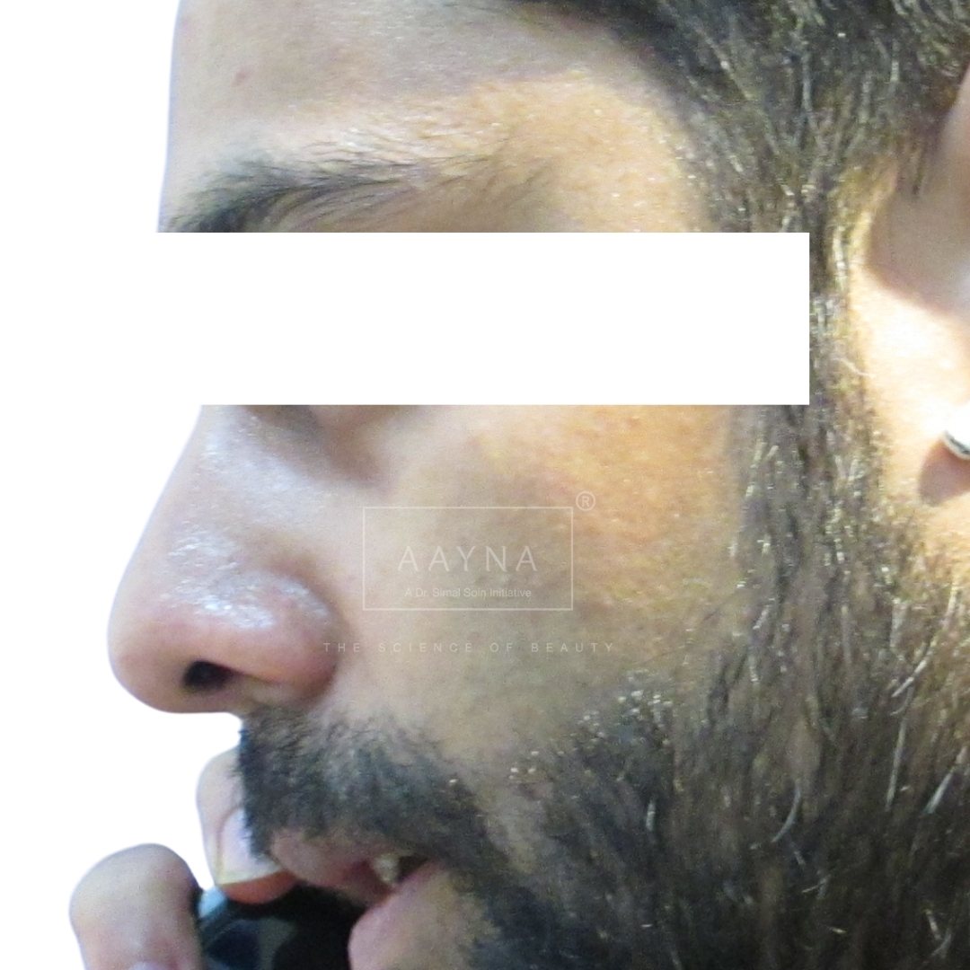 before-img
