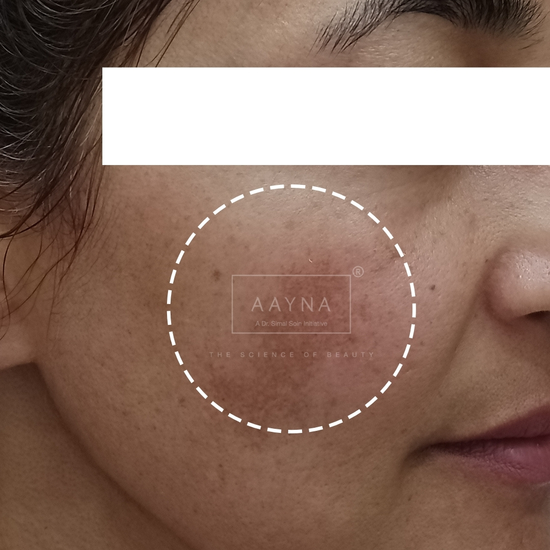 before-img