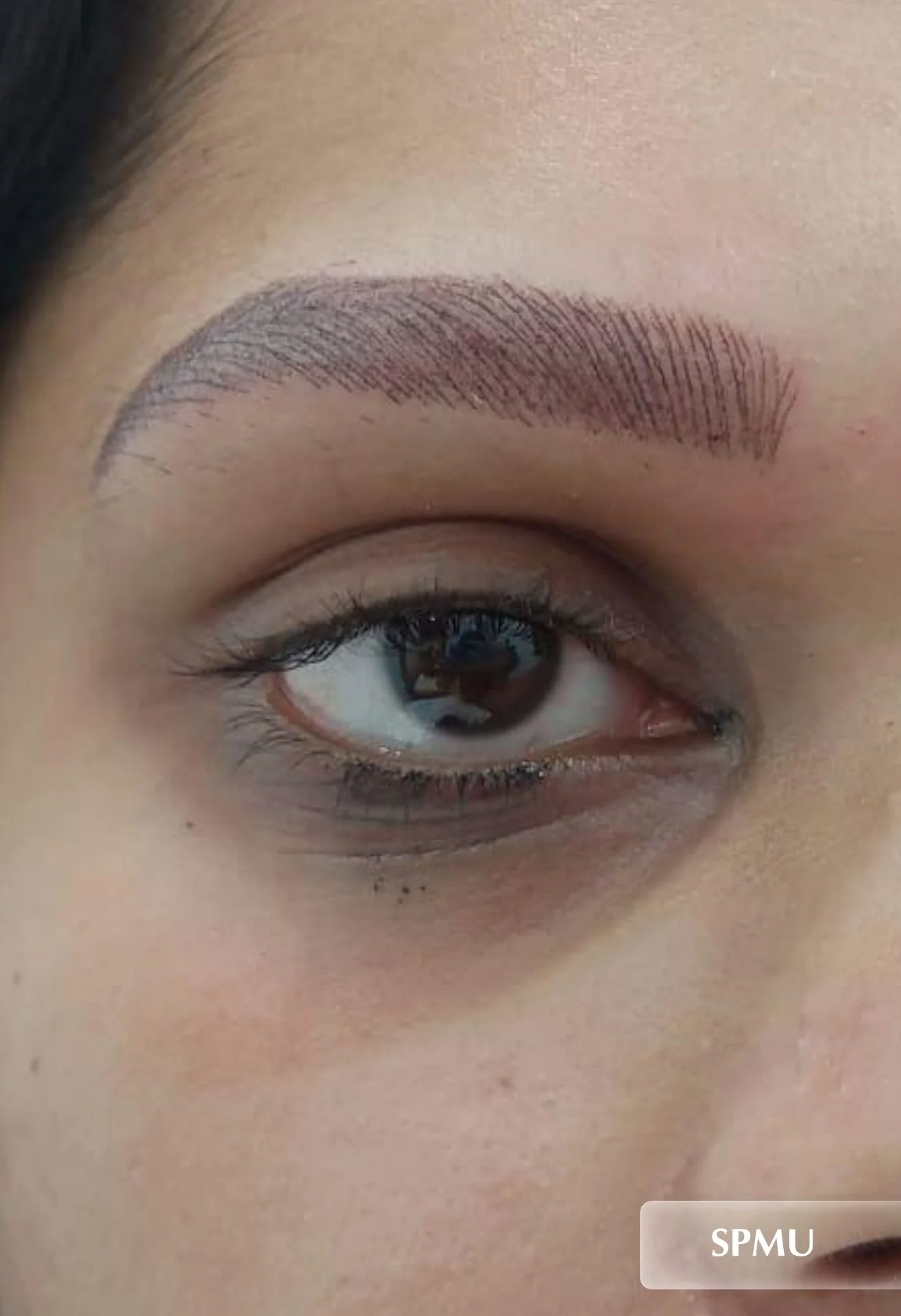 after-img