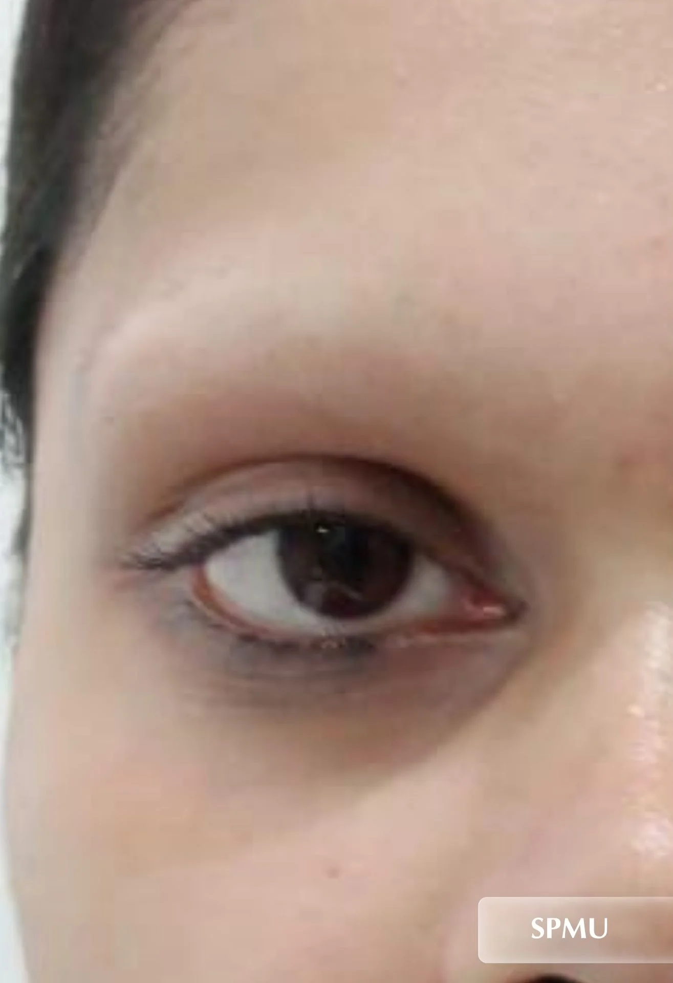 before-img
