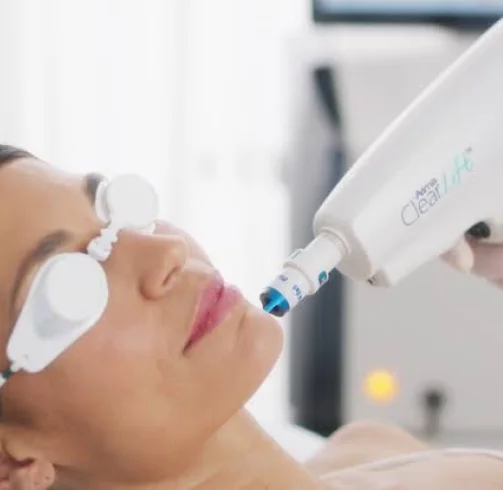 ClearLift Treatment