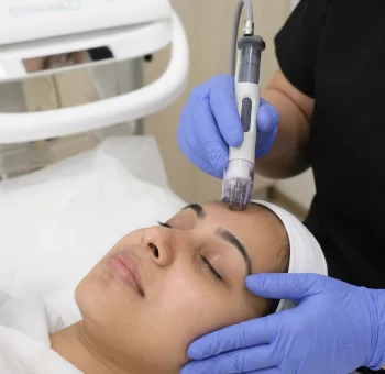 DERMA GENESIS- DERMAFRAC