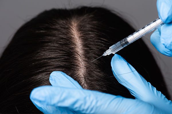 GFC Hair Treatment