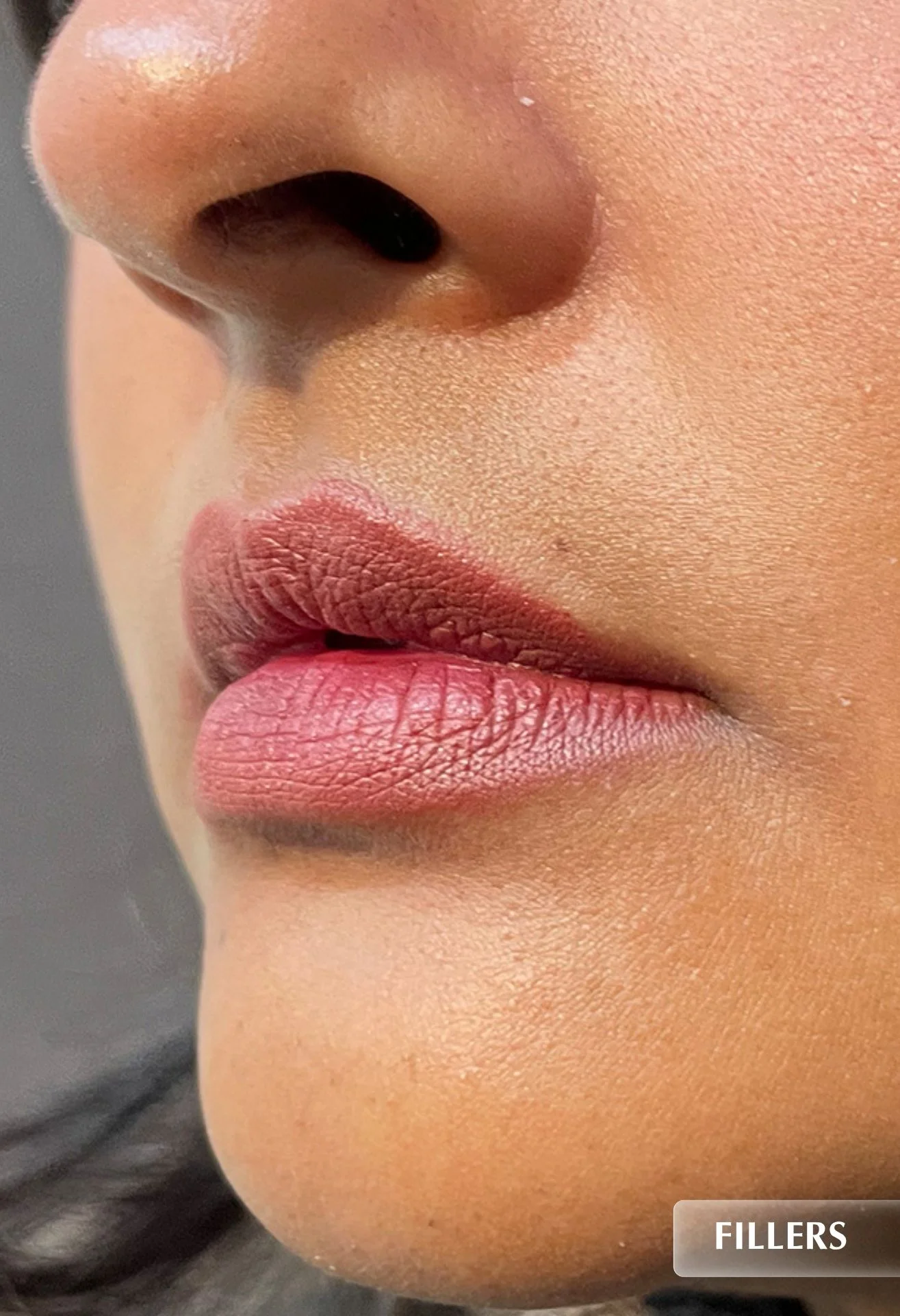 before-img