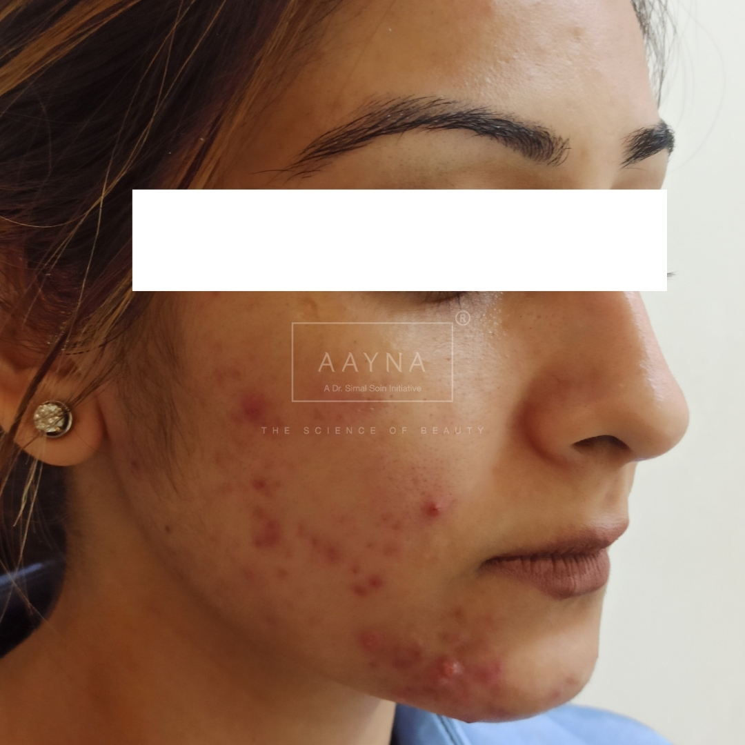 before-img