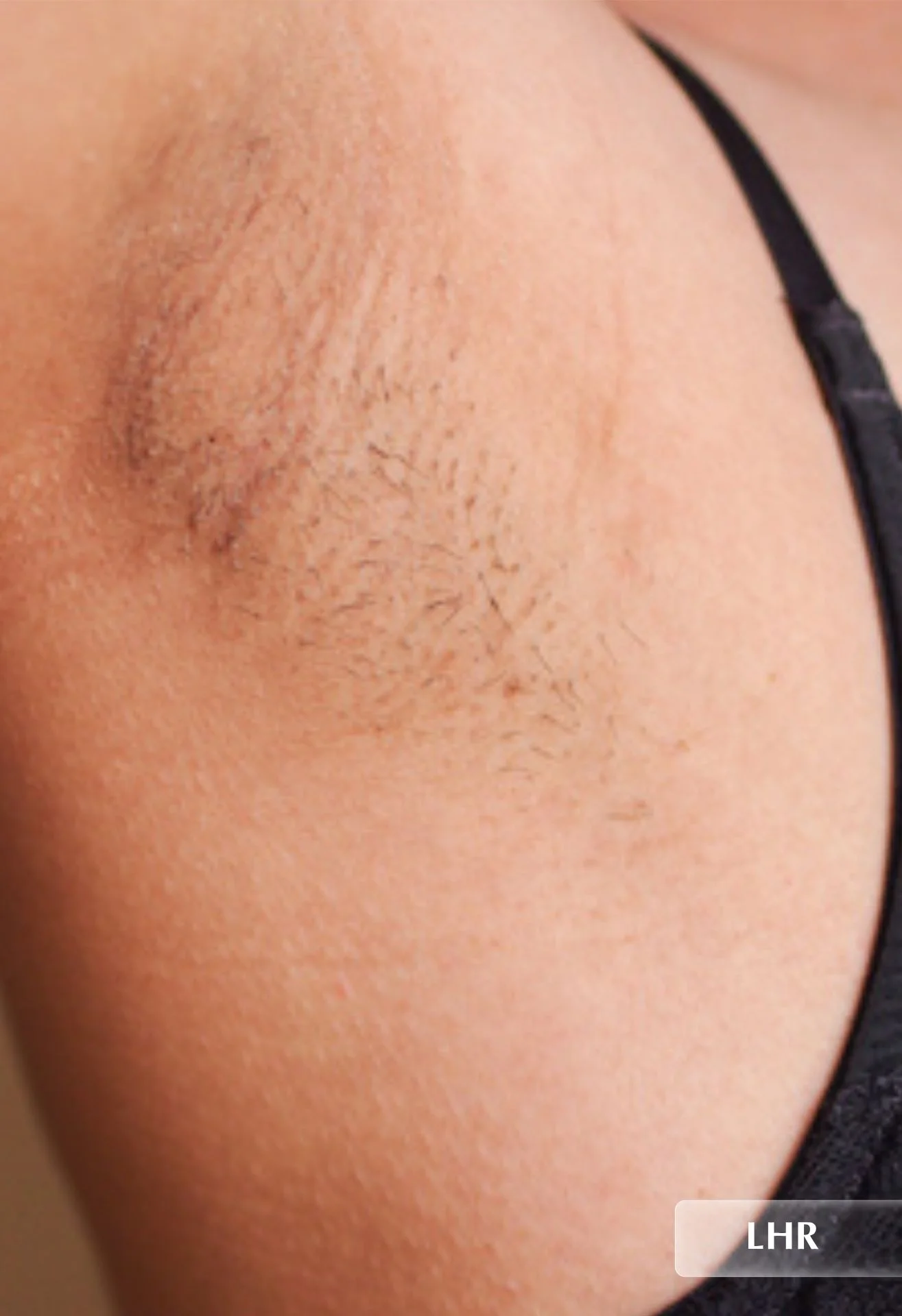 before-img