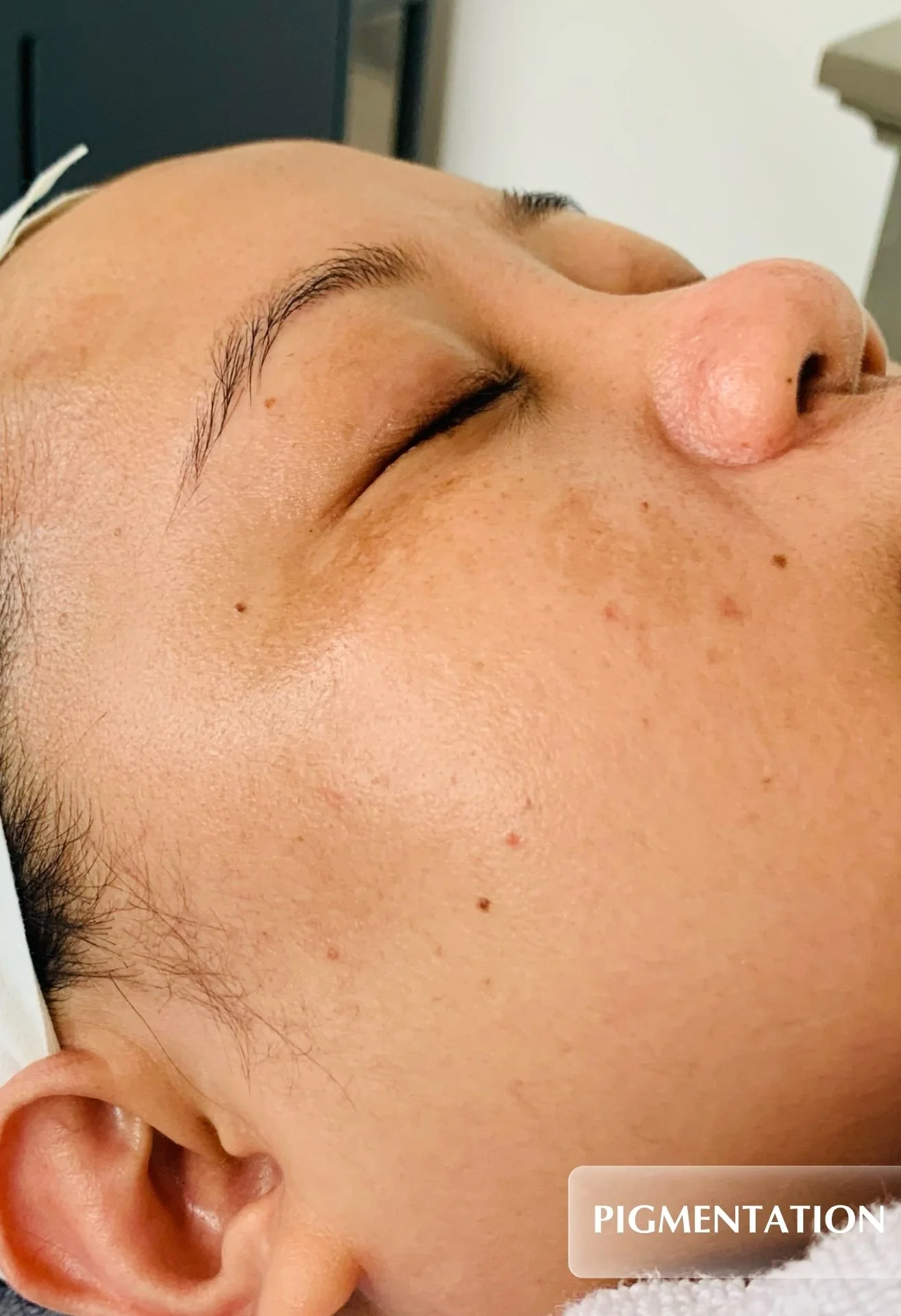 before-img
