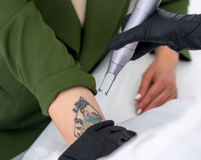 PICO Laser vs Personalised Skin Treatments: What Does Your Skin Really Need?