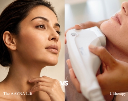 The AAYNA Lift vs Ultherapy: Which Is Better?
